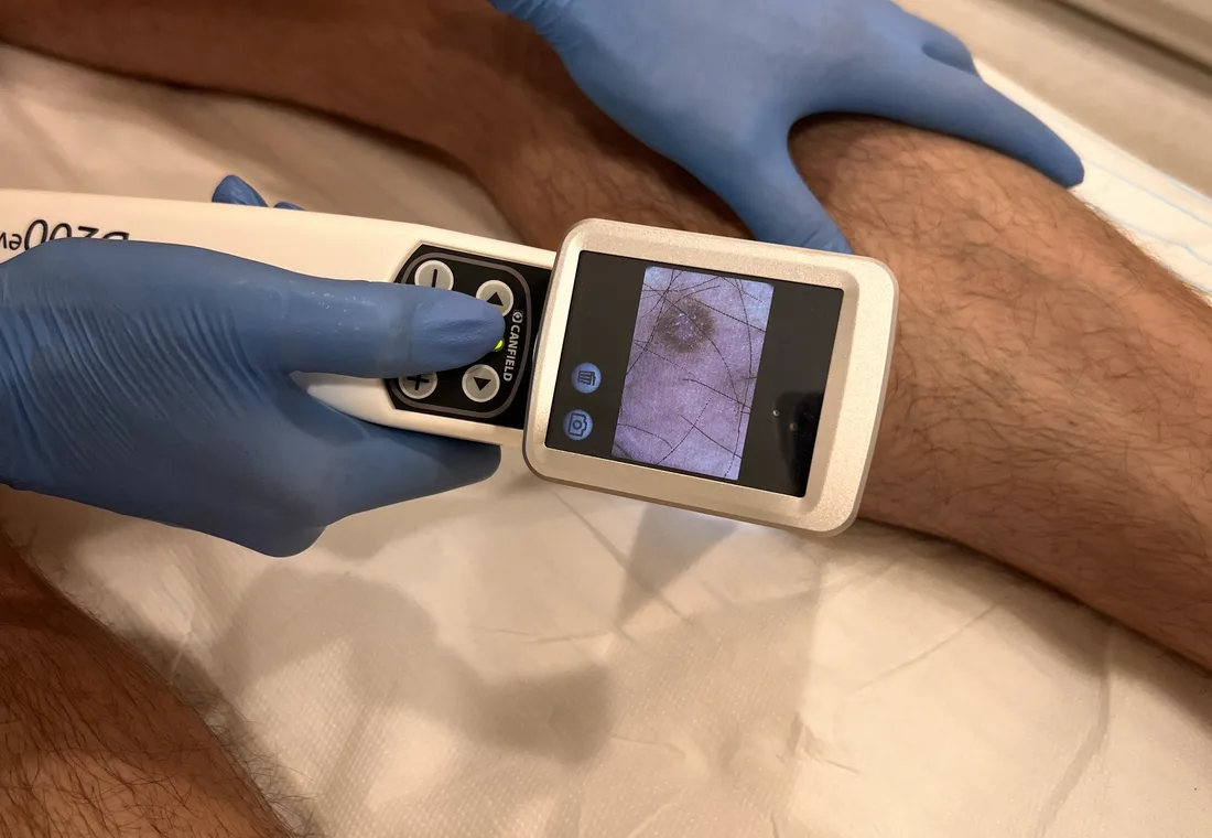 Diagnostyka zmiany skórnej w gabinecie dermatologicznym
