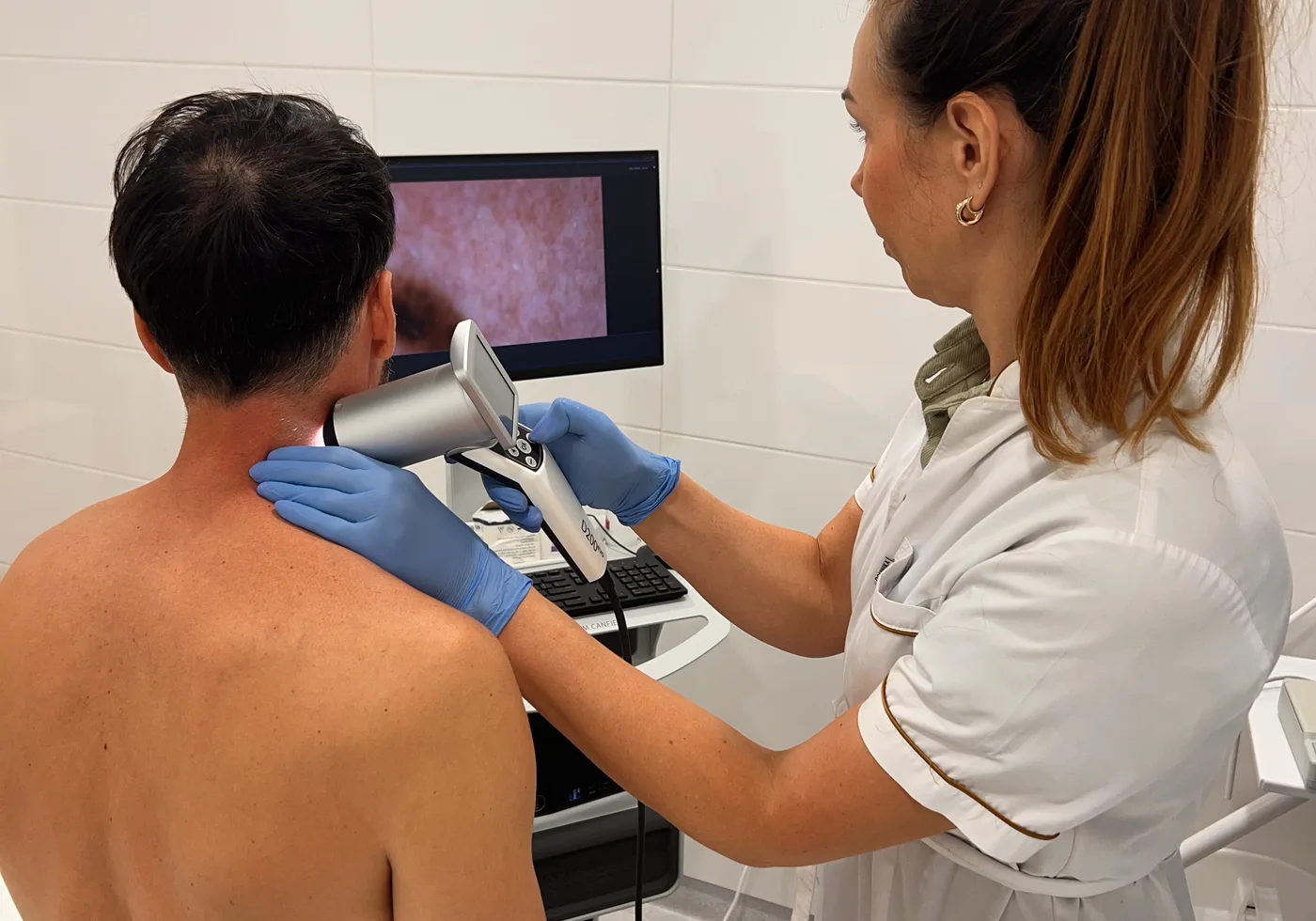 Wideodermatoskopia i diagnostyka czerniaka w Clinica Dermatologica w Gdańsku